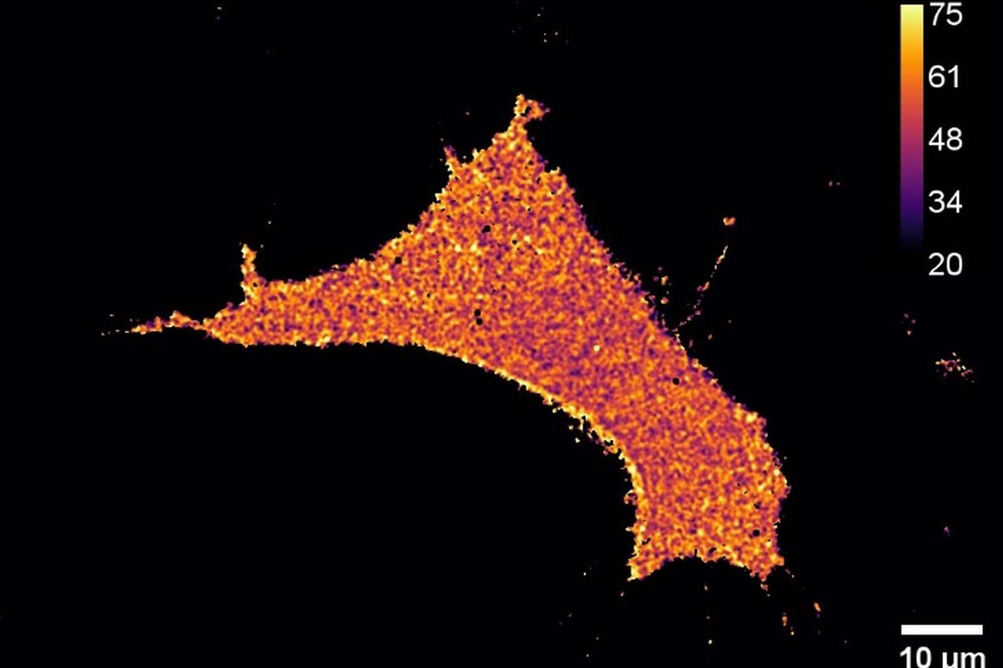 image d'une cellule montrant l'efficacité FRET en échelle de couleur