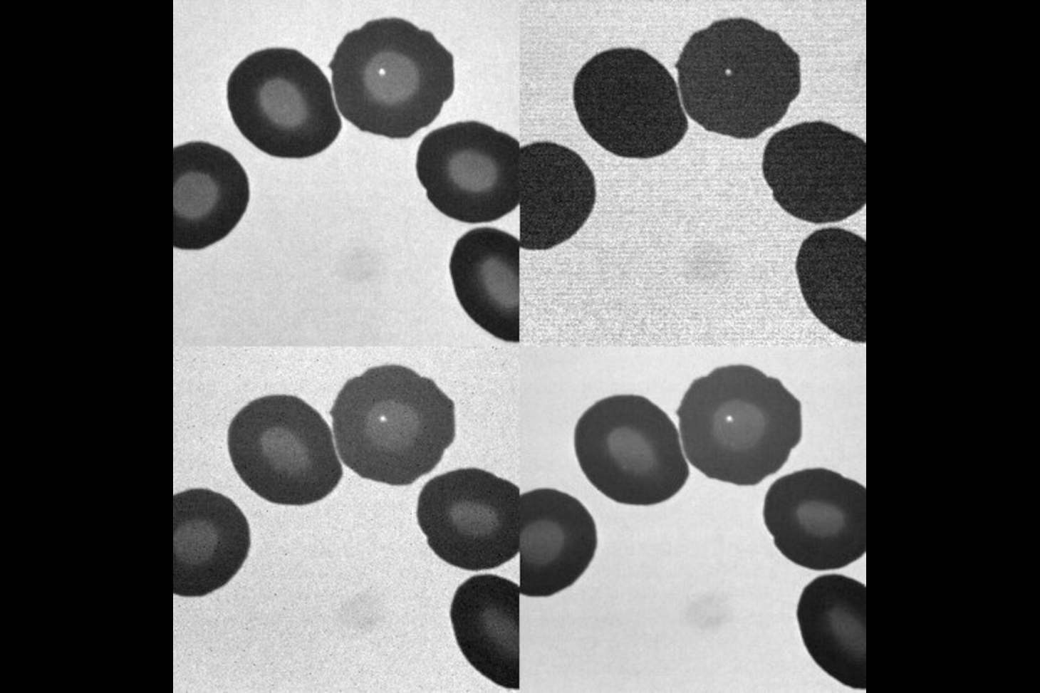 globules rouges imagées par plusieurs méthodes