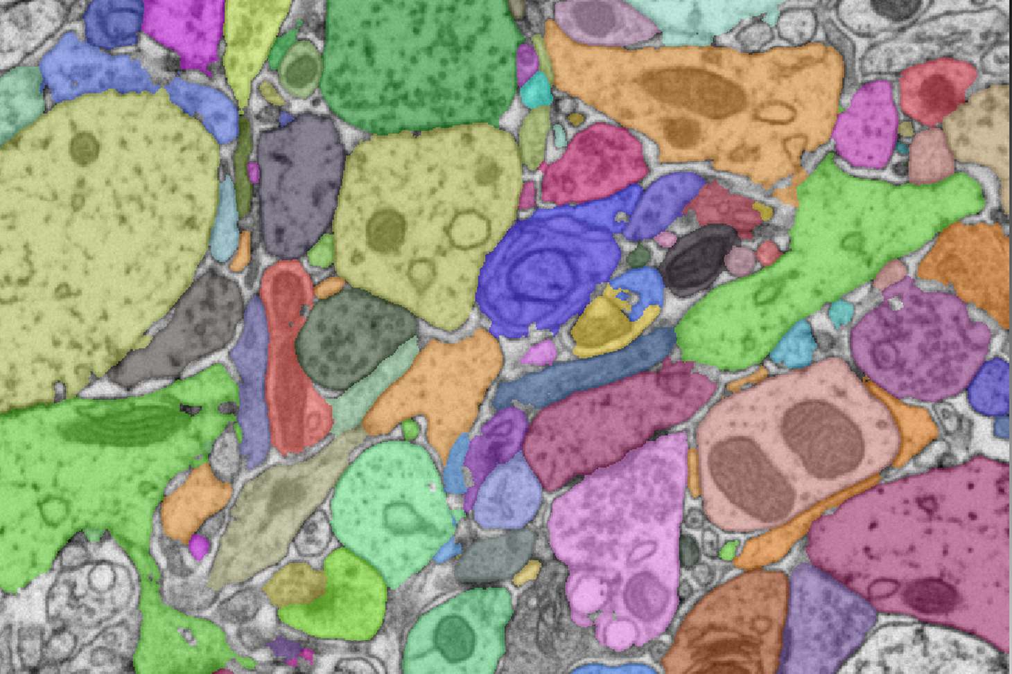 segmentation image électronique - Crédits: K. Pernet-Gallay, GIN