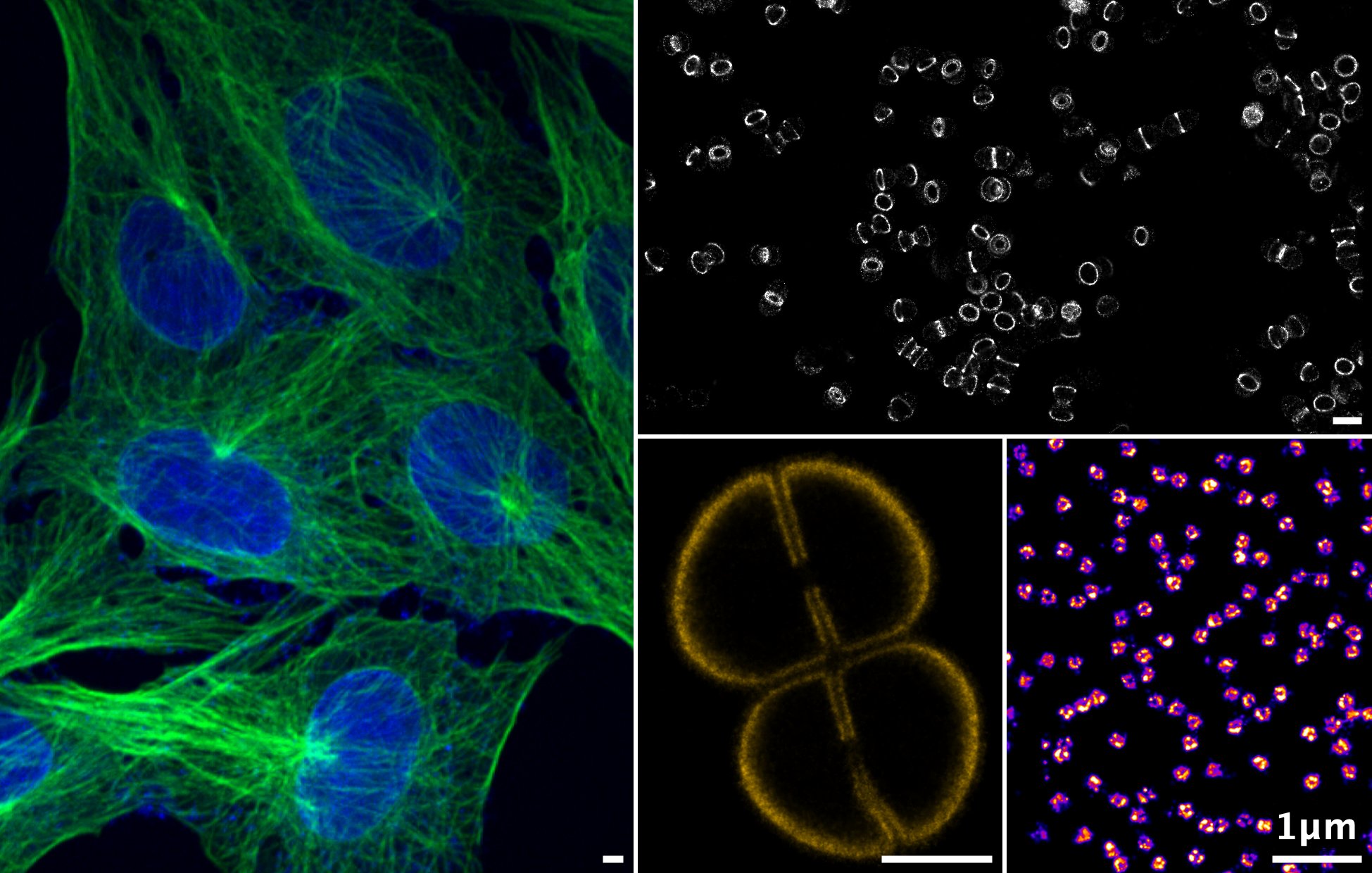 Imagerie par fluorescence