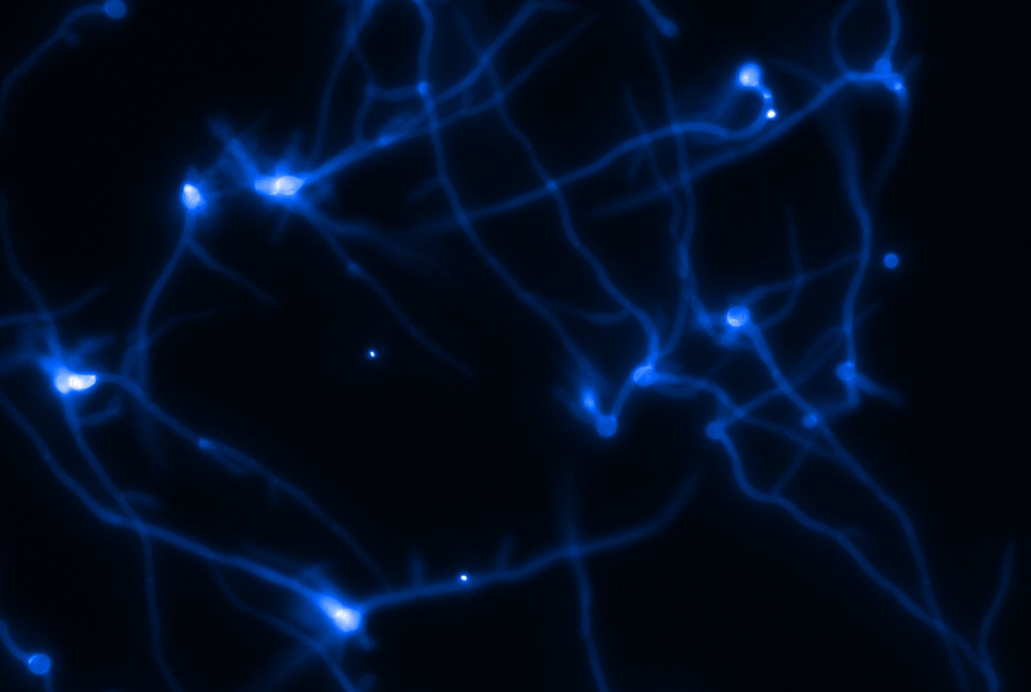 Image-Levures-Filaments